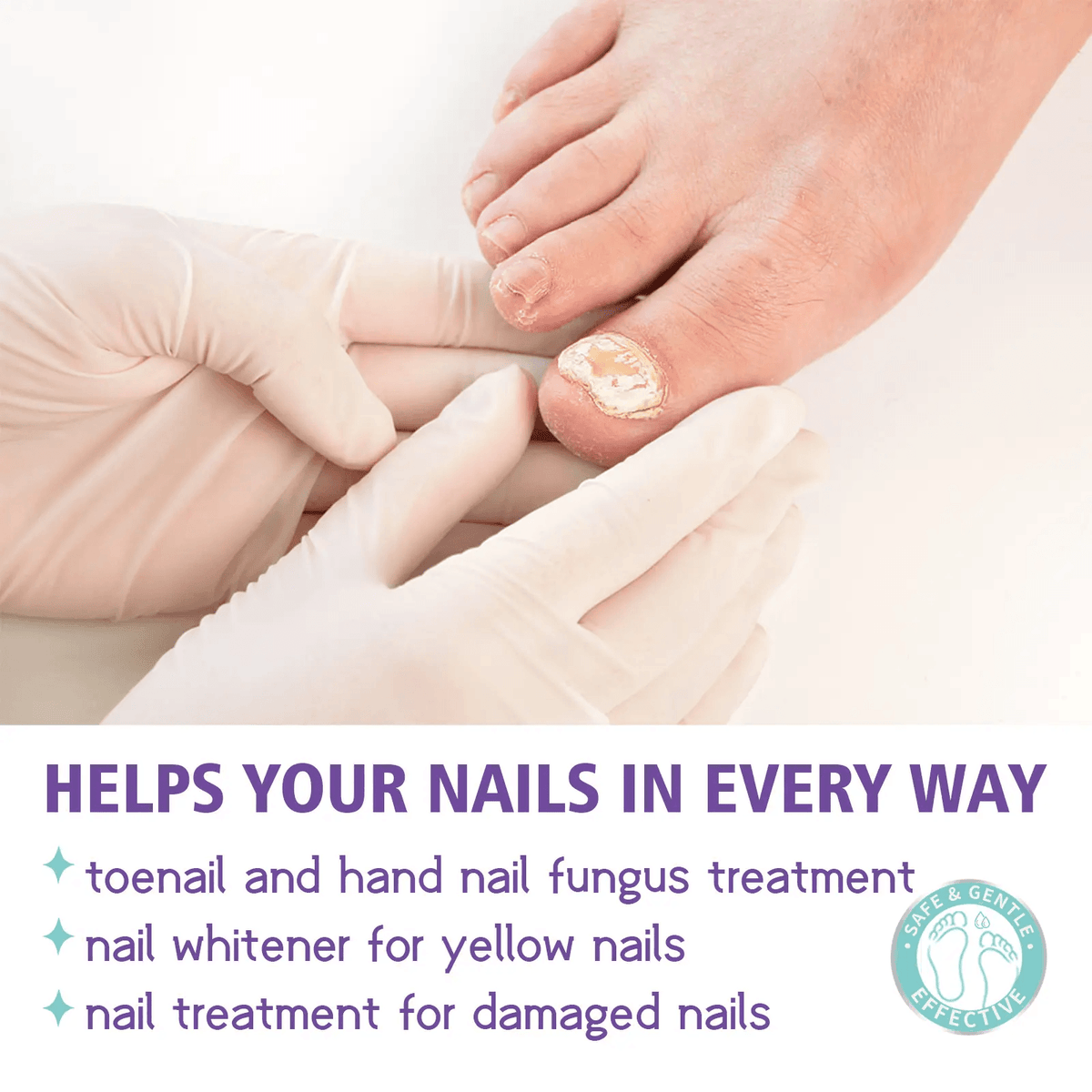 Extra Strong Nail Fungus Treatment Spray 100ml (رذاذ)